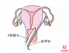 试管婴儿对女性的伤害有哪些？