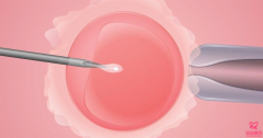 海外试管婴儿助孕的过程中，「胚胎活检」的具体步骤是怎样的？
